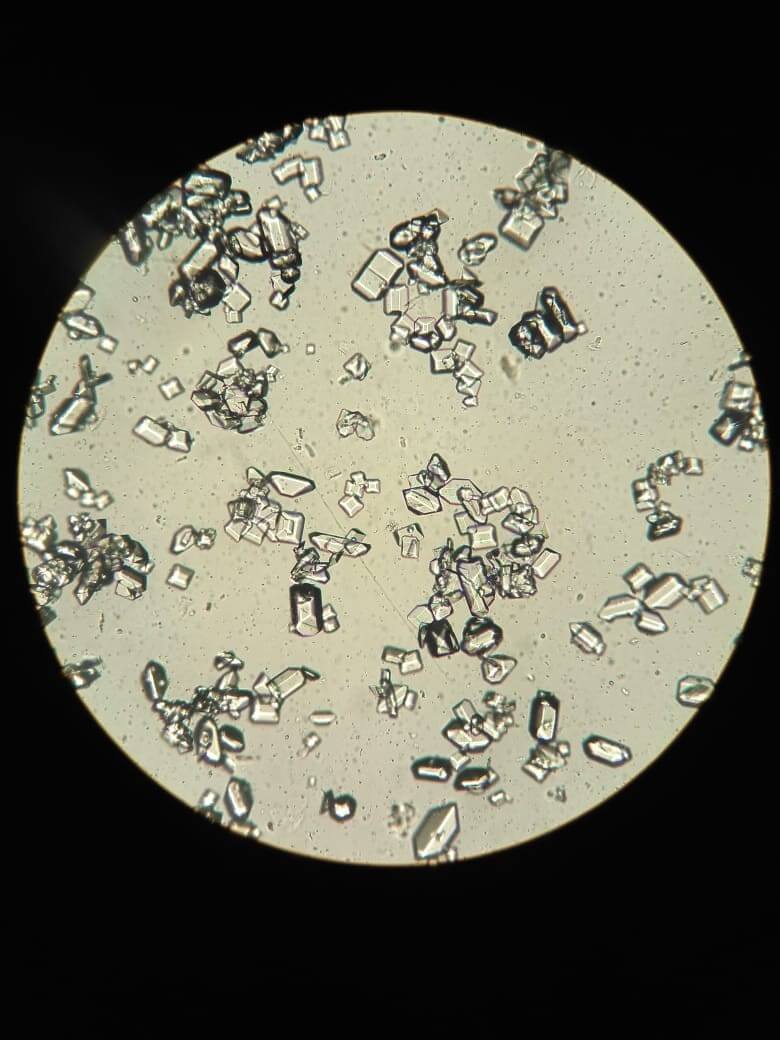 Мочевой осадок под микроскопом